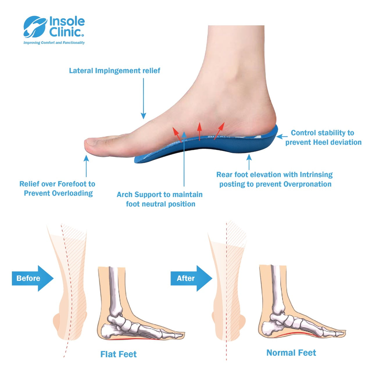 Best 3/4 L Orthotic Insoles UK | Shoe Inserts for Arch Support